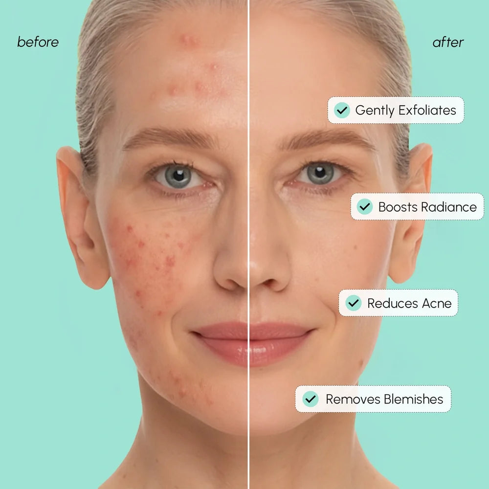 Azelaic Acid Soothing Pads